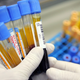 A laboratory technician checks human blood samples before placing the glass tubes on an automated testing line at the Maccabi Health Services HMO central laboratory in Nes Tsiona, Israel
